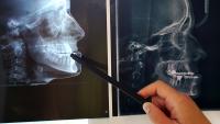 Dentist reviewing x-ray in preparation for maxillofacial surgery